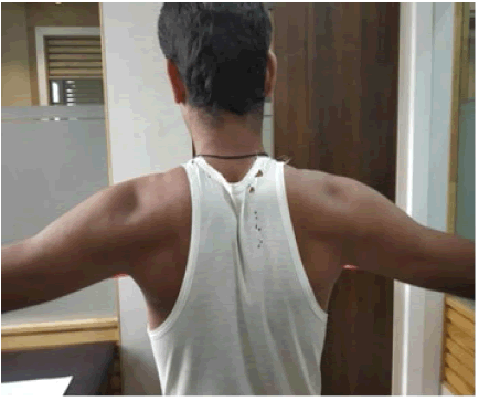 clinical-practice-Scapular