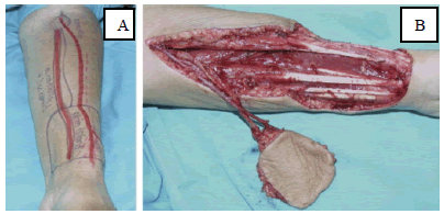 clinical-practice-forearm