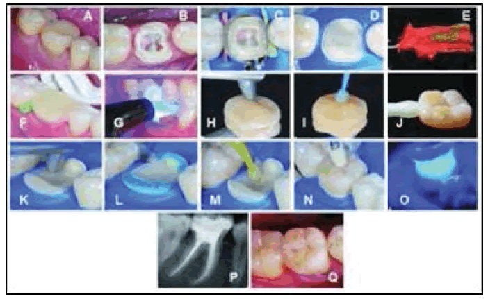 clinical-practice-fulladhesive