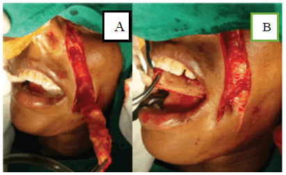 clinical-practice-nasolabial