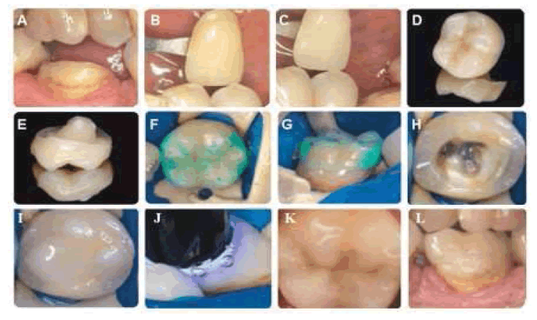 clinical-practice-occlusion