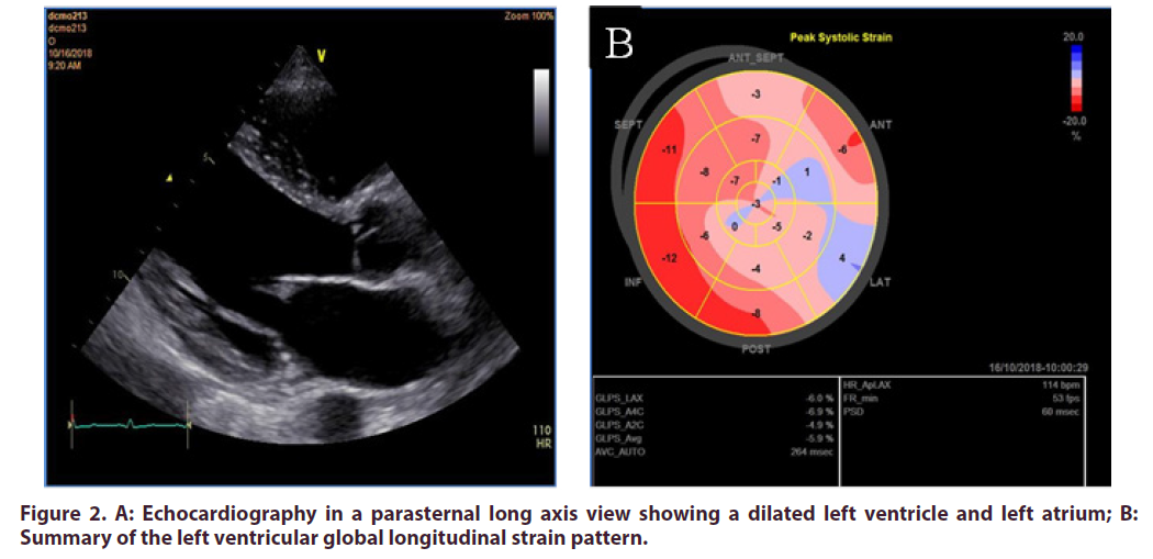 clinical-rheumatology-Echocardiography