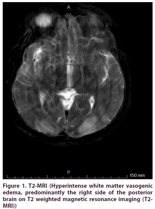 clinical-rheumatology-Hyperintense