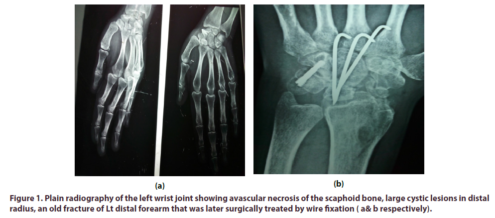 clinical-rheumatology-Plain