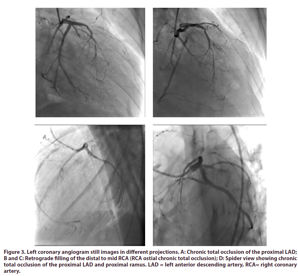 clinical-rheumatology-coronary