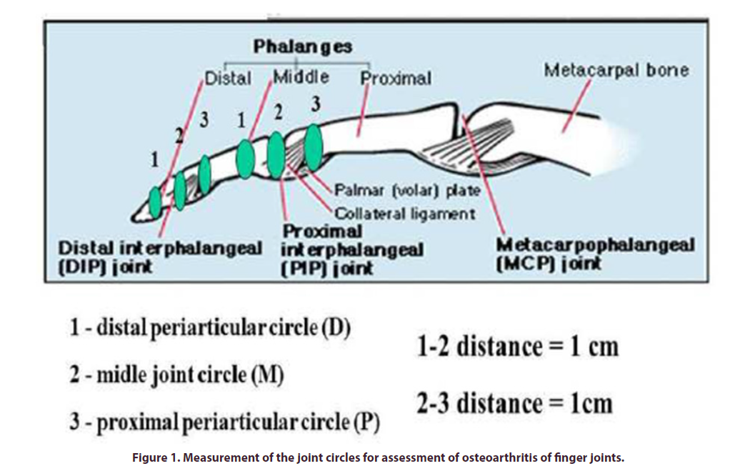 clinical-rheumatology-joint