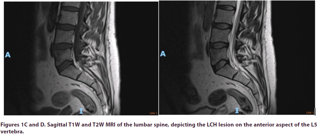 clinical-rheumatology-lumbar