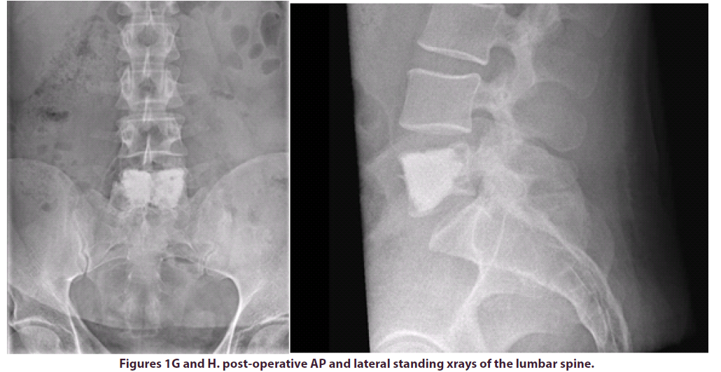 clinical-rheumatology-standing