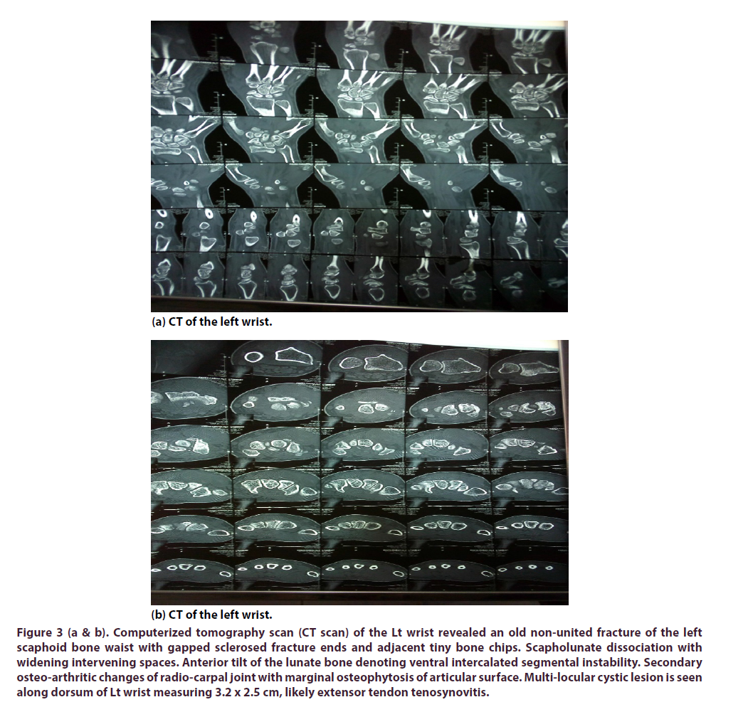 clinical-rheumatology-tomography