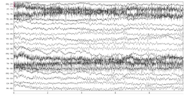 fmci-12-12-Original