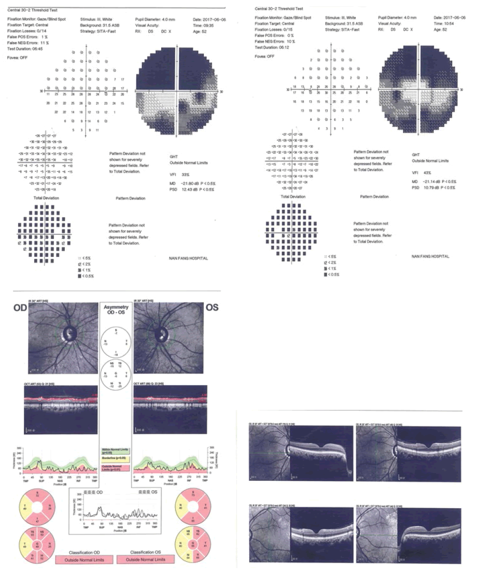 fmci-Ophthalmic