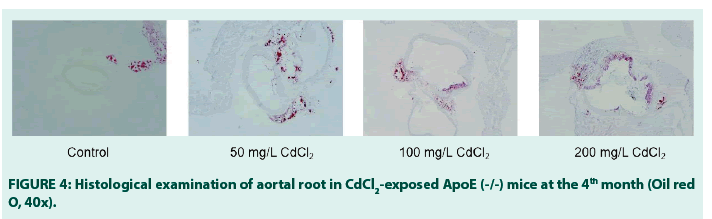 fmdm-aortal