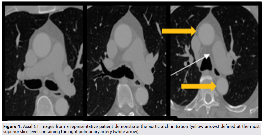 imaging-medicine-axial