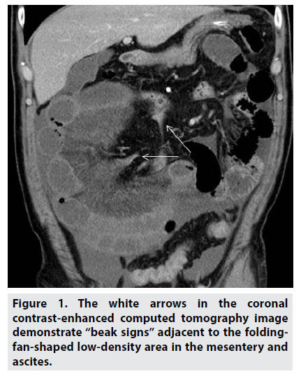 imaging-medicine-coronal