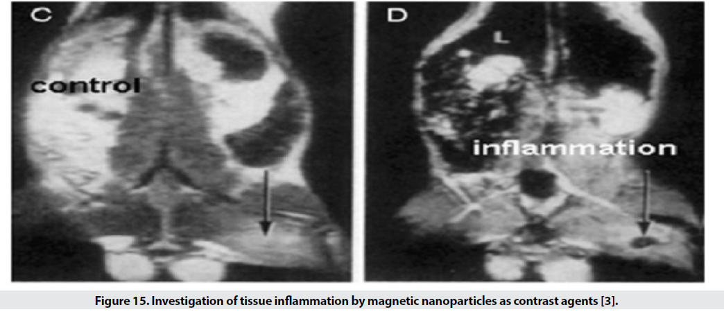 imaging-medicine-inflammation