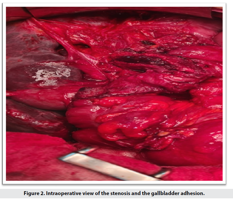 imaging-medicine-intraoperative