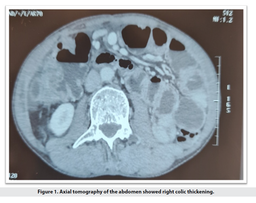 imaging-medicine-tomography