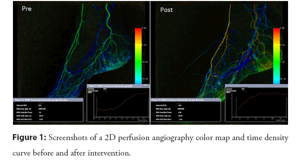 interventional-angiography