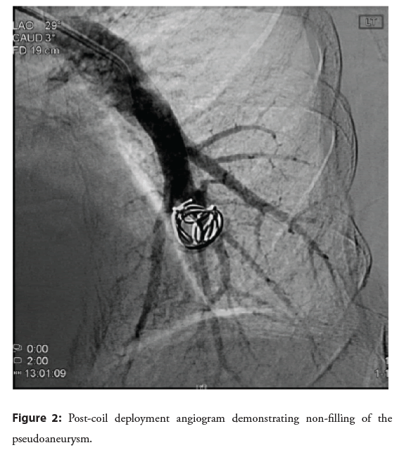 interventional-cardiology-angiogram