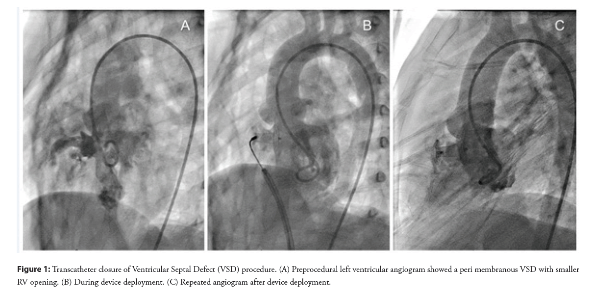 interventional-cardiology-angiogram