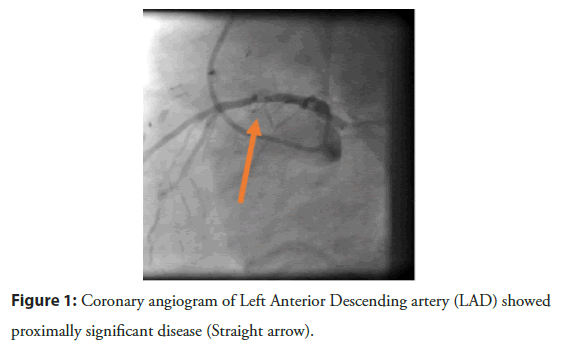 interventional-cardiology-angiogram