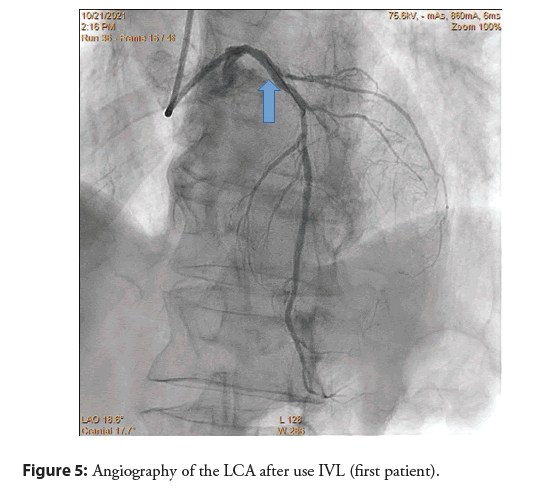 interventional-cardiology-angiography