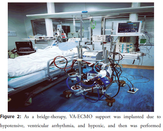 interventional-cardiology-arrhythmia