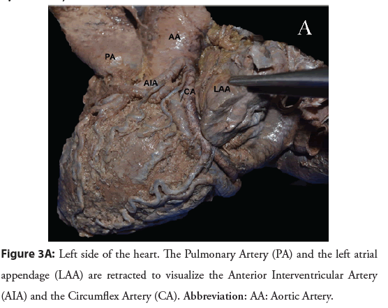 interventional-cardiology-atrial