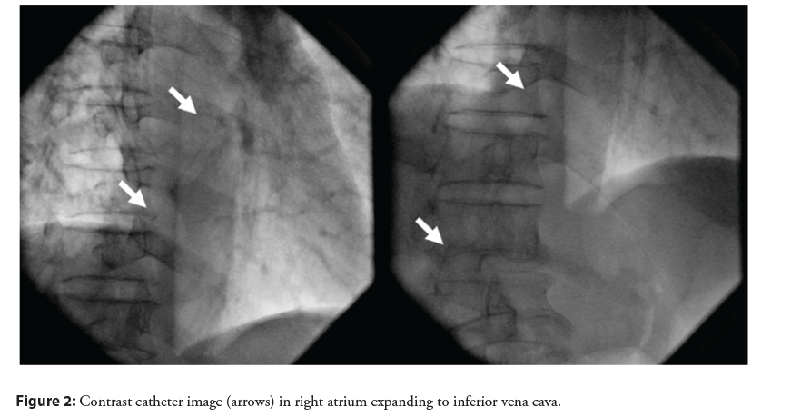 interventional-cardiology-atrium