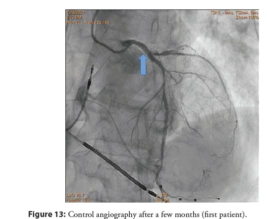 interventional-cardiology-control