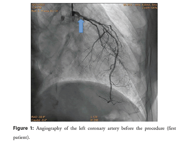 interventional-cardiology-coronary