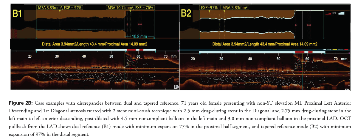 interventional-cardiology-discrepancies