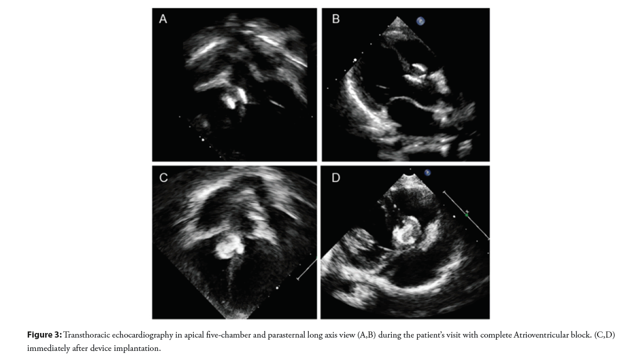 interventional-cardiology-echocardiography