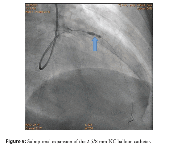 interventional-cardiology-expansion