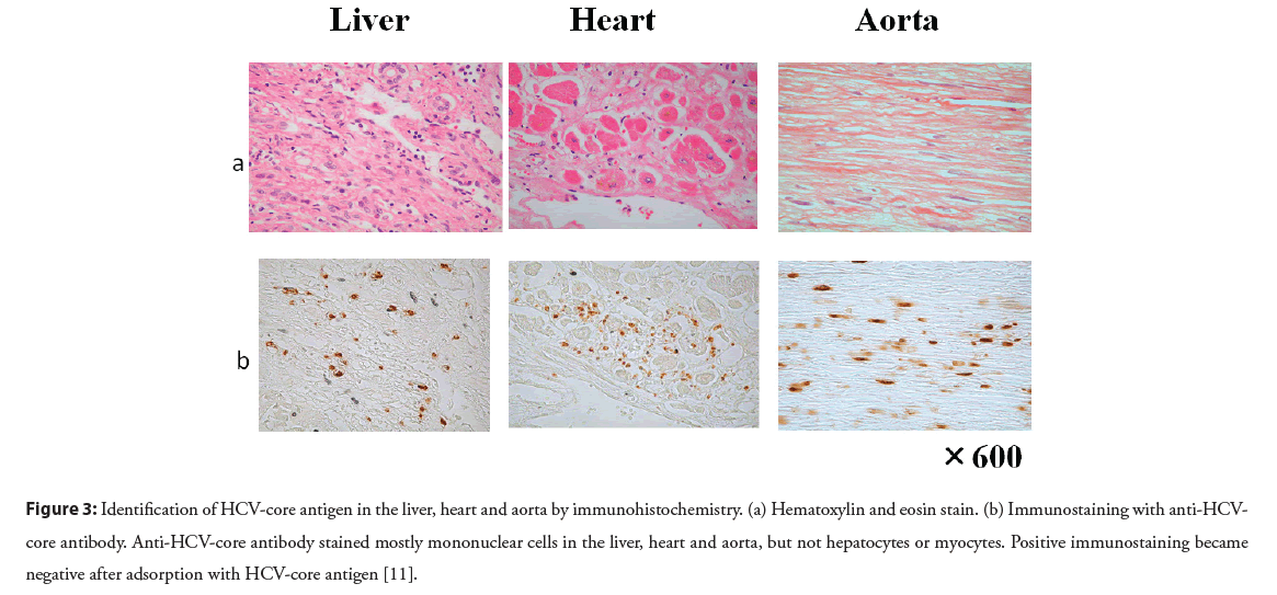 interventional-cardiology-immunohistochemistry