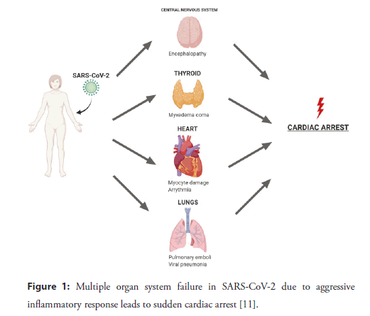 interventional-cardiology-inflammatory