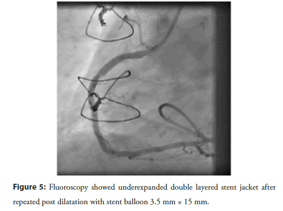 interventional-cardiology-jacket