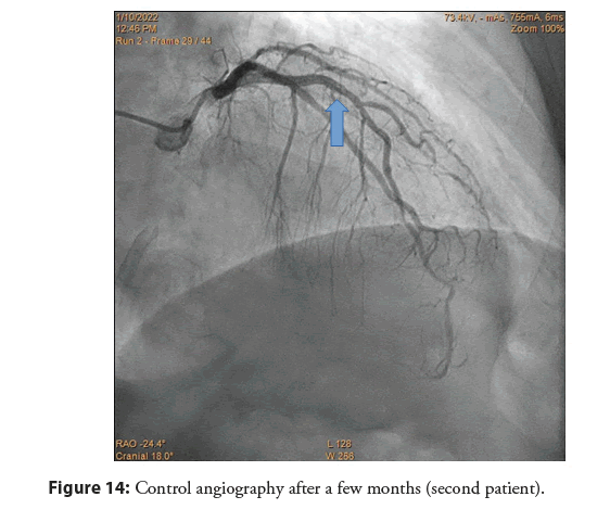 interventional-cardiology-months