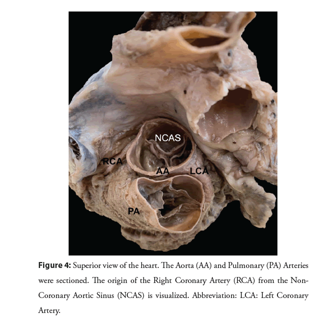 interventional-cardiology-origin