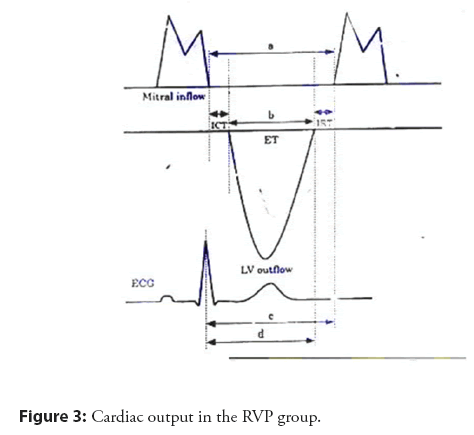 interventional-cardiology-output