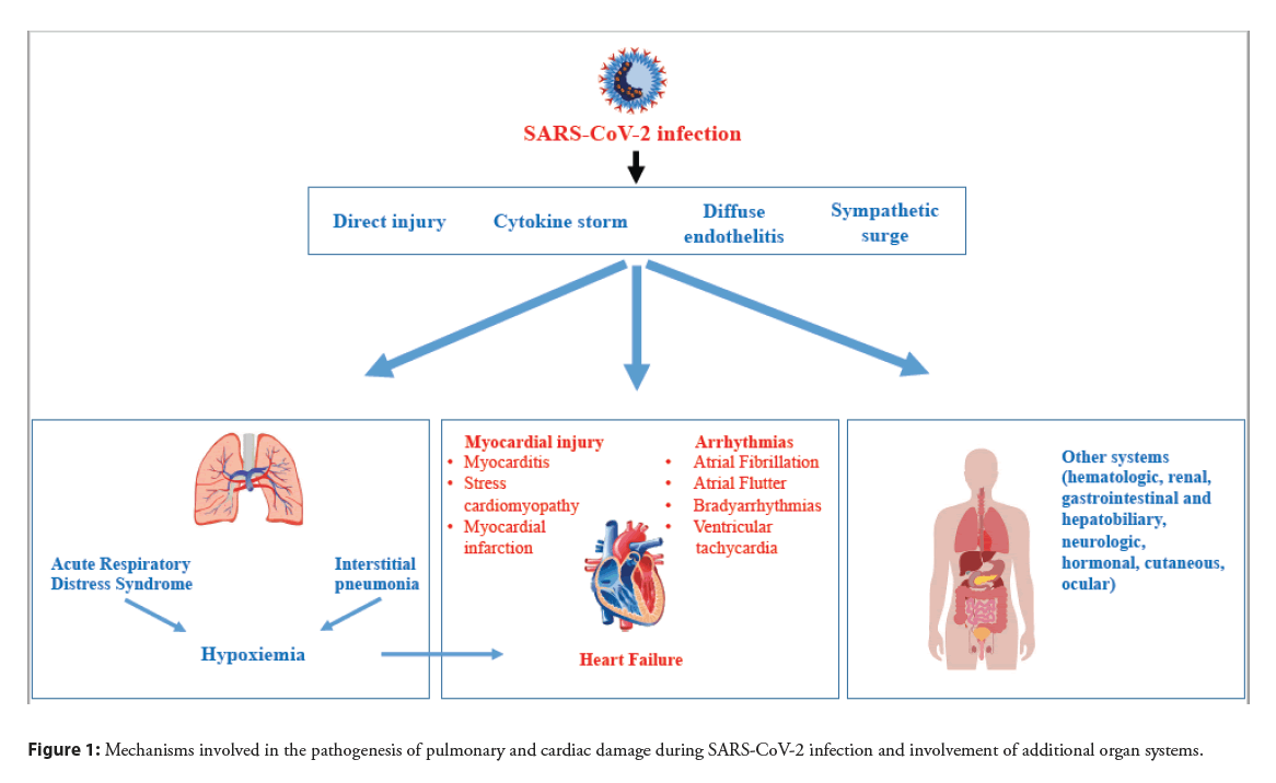 interventional-cardiology-pathogenesis