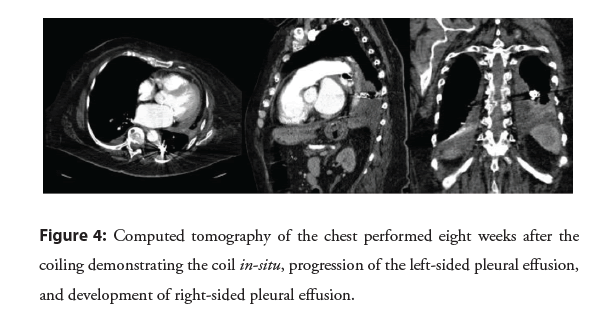 interventional-cardiology-pleural