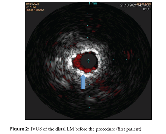 interventional-cardiology-procedure