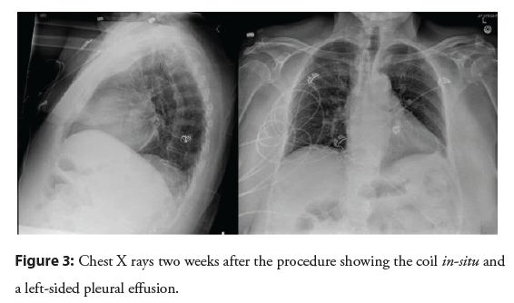 interventional-cardiology-procedure