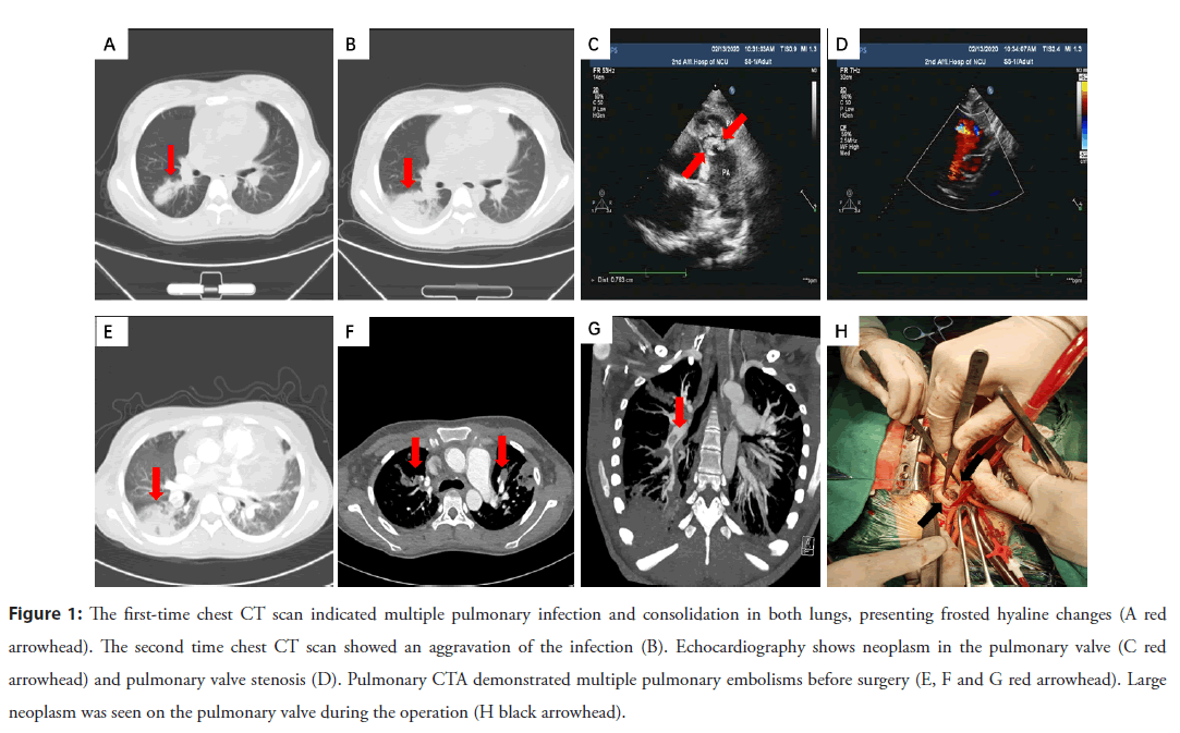 interventional-cardiology-pulmonary