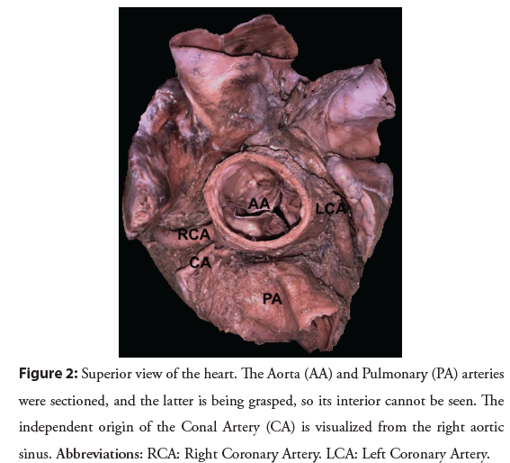 interventional-cardiology-pulmonary