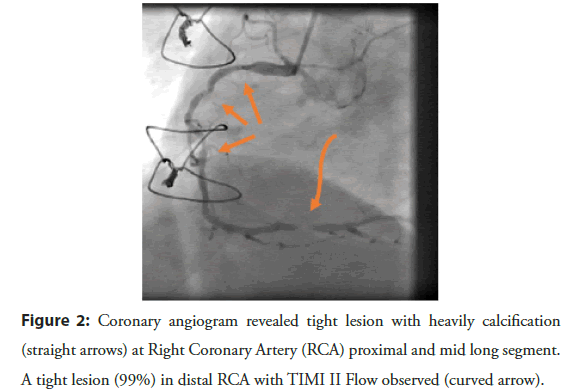 interventional-cardiology-revealed