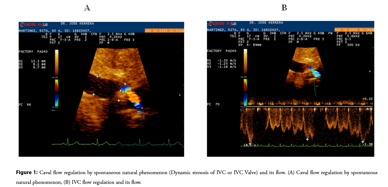 interventional-cardiology-spontaneous