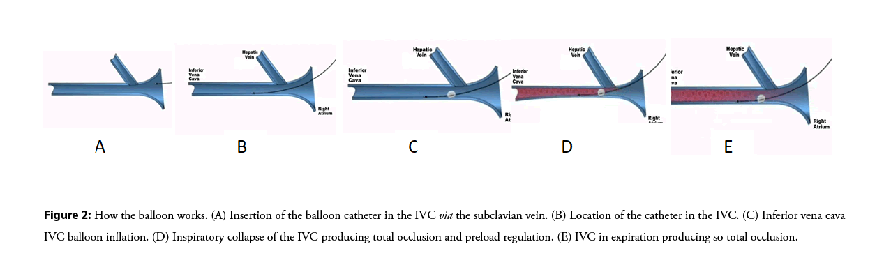 interventional-cardiology-subclavian