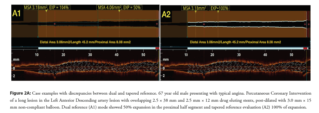 interventional-cardiology-tapered